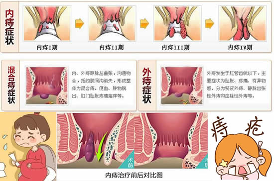 wangweixuan 第5页